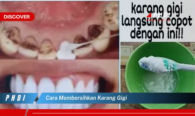 cara membersihkan karang gigi