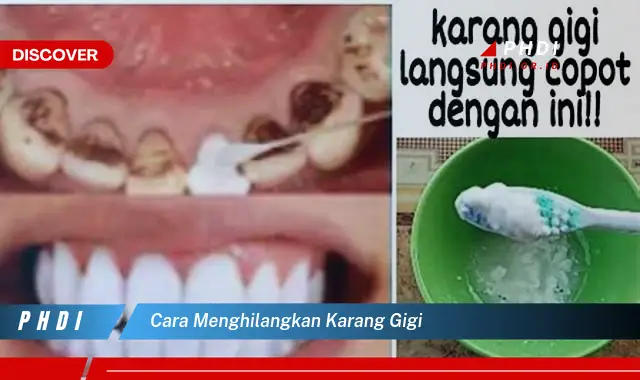 cara menghilangkan karang gigi