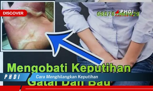 cara menghilangkan keputihan