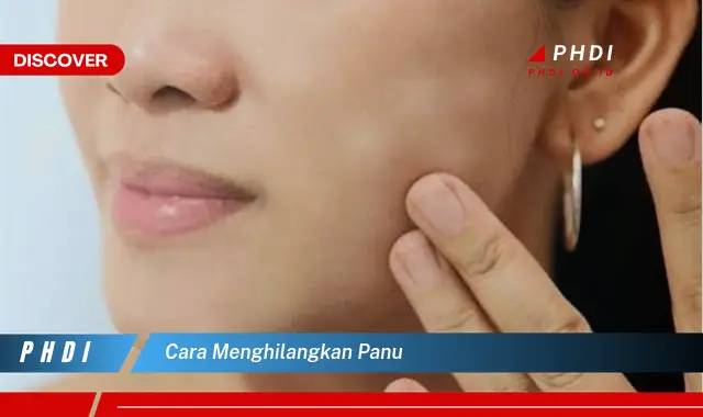 cara menghilangkan panu