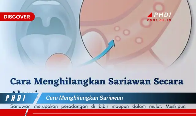 cara menghilangkan sariawan