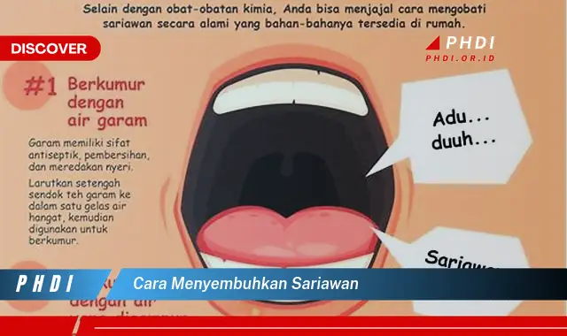 cara menyembuhkan sariawan