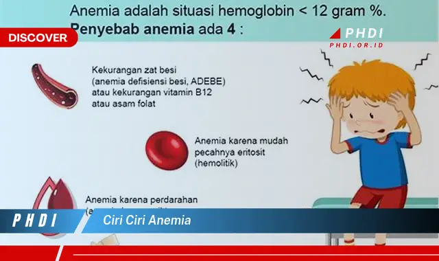 Ketahui Ciri Ciri Anemia yang Jarang Diketahui