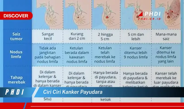 ciri ciri kanker payudara