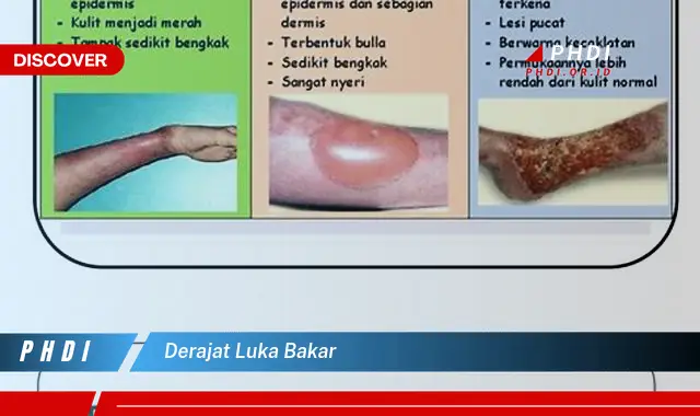 derajat luka bakar