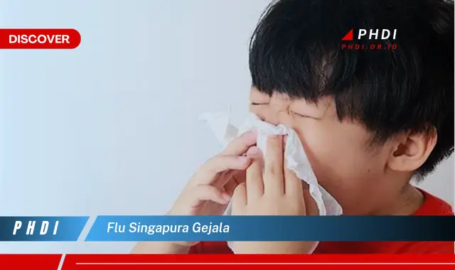 flu singapura gejala