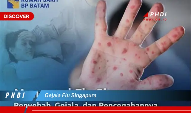 gejala flu singapura