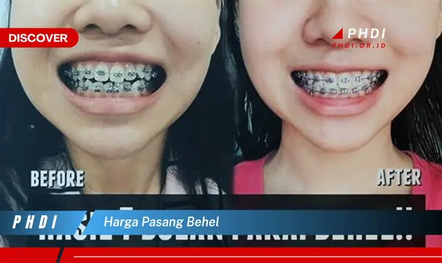 harga pasang behel