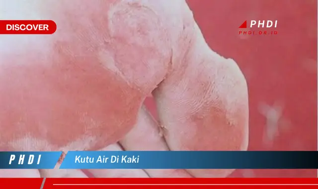 kutu air di kaki