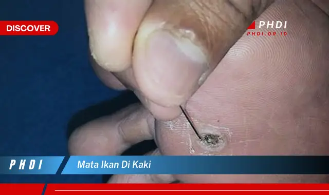 mata ikan di kaki