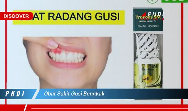 obat sakit gusi bengkak