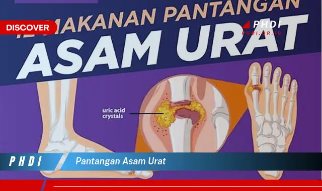 pantangan asam urat