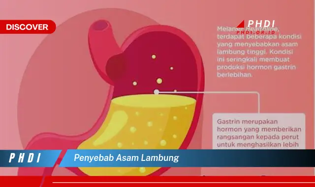 penyebab asam lambung