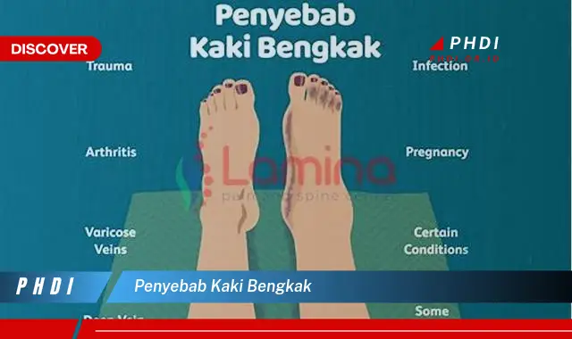 penyebab kaki bengkak