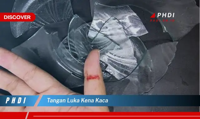 tangan luka kena kaca