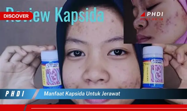 manfaat kapsida untuk jerawat