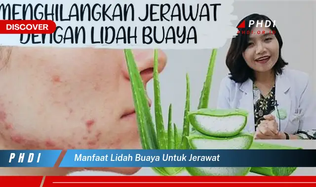 manfaat lidah buaya untuk jerawat