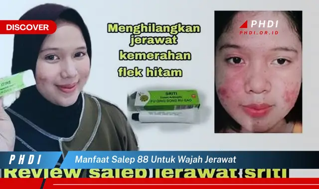 Ketahui Manfaat Salep 88 untuk Wajah Jerawat yang Wajib Kamu Intip