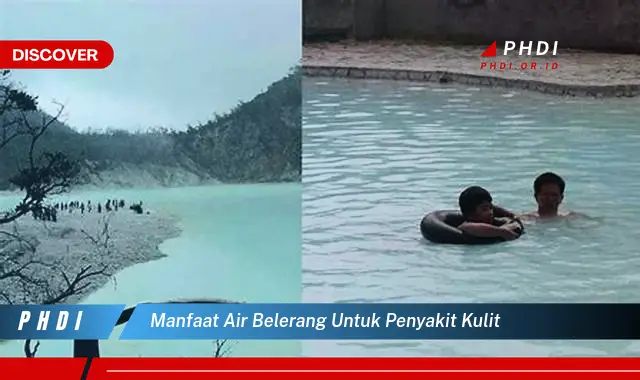 manfaat air belerang untuk penyakit kulit