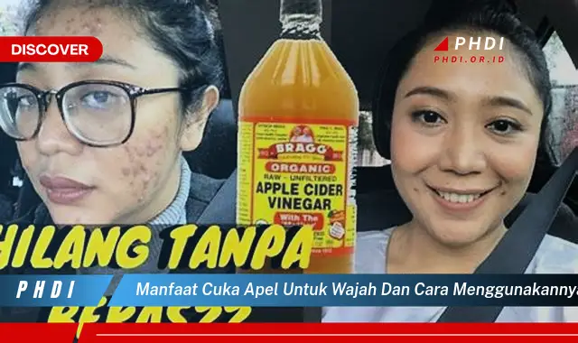 manfaat cuka apel untuk wajah dan cara menggunakannya