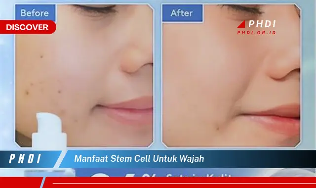 manfaat stem cell untuk wajah