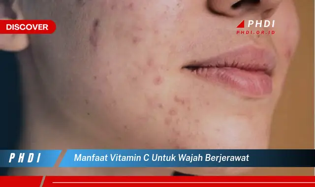 manfaat vitamin c untuk wajah berjerawat